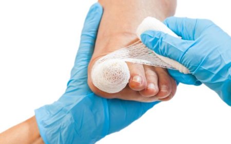 How Fast Can You Heal From Nail Surgery? Ask Edinburgh Experts