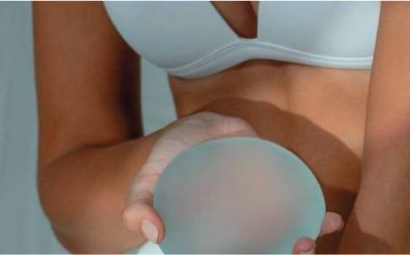 Breast Augmentation Dubai: Enhance Your Confidence with Natural-Looking Results
