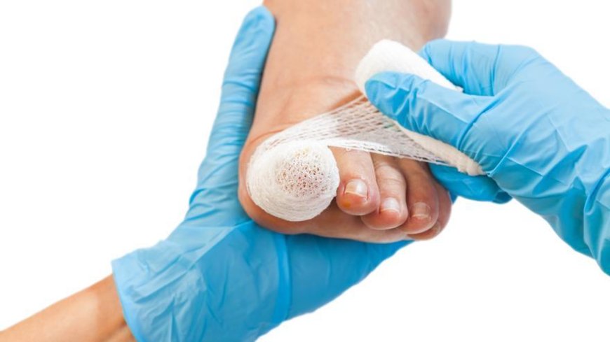 How Fast Can You Heal From Nail Surgery? Ask Edinburgh Experts