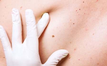 Restore Healthy Skin: Trusted Solutions for Scars, Skin Cancer & Wart Removal Near You