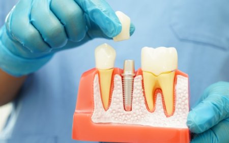 🦷 Restore Your Smile with Comfortable, Natural-Looking Dentures