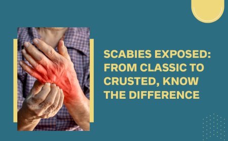 Scabies on Back of Neck: Early Warning Signs