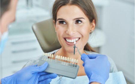 What Can I Do to Maintain the Results of Teeth Whitening?
