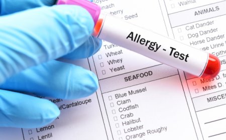 Which Test is Mostly Favoured for Testing Allergy: Prick Test or Blood Test?