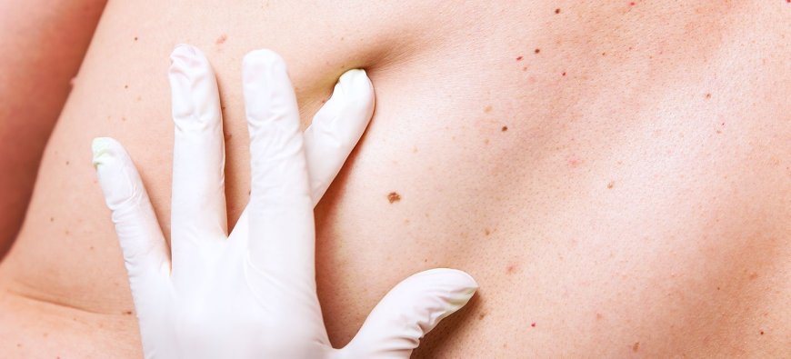 Restore Healthy Skin: Trusted Solutions for Scars, Skin Cancer & Wart Removal Near You