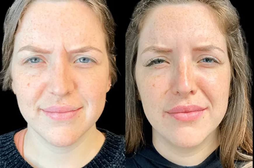 Safety and Precision at the Best Aesthetic Clinic in Dubai: Why It Matters