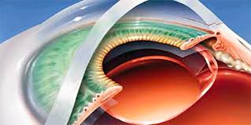 Vision Laser Surgery: A Clear Path to Better Sight