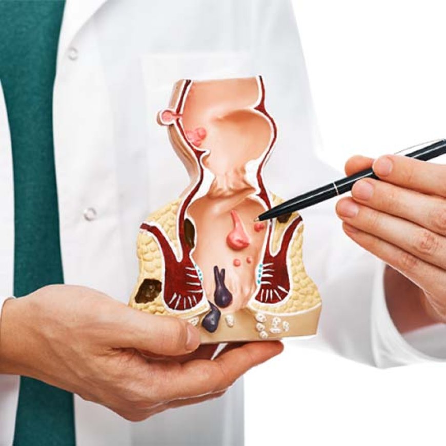 How can I find a reputable piles doctor Mumbai?