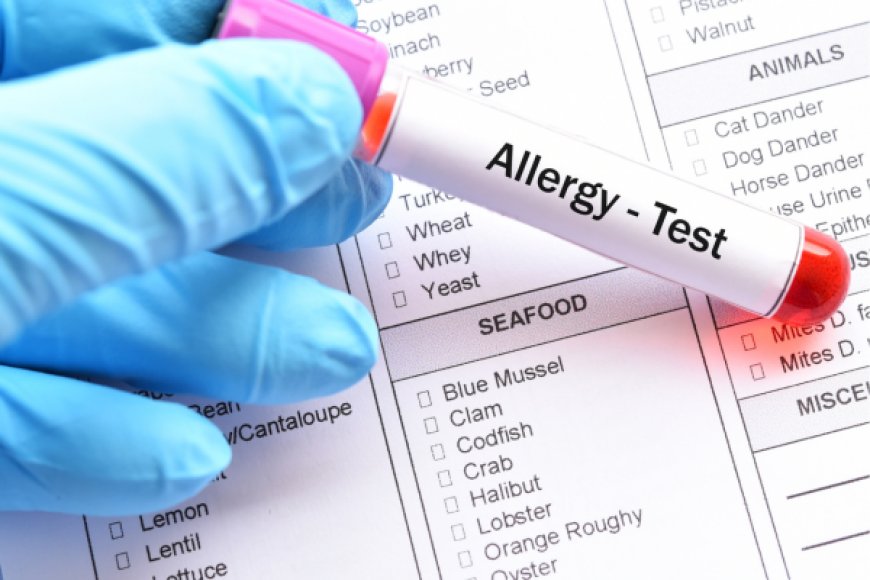 Which Test is Mostly Favoured for Testing Allergy: Prick Test or Blood Test?