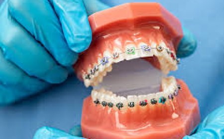 Which Dental Clinics in Gurgaon Use Advanced Technology?