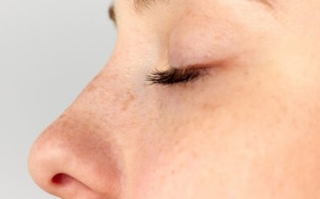 Rhinoplasty in Islamabad: Tailoring Results to Your Face