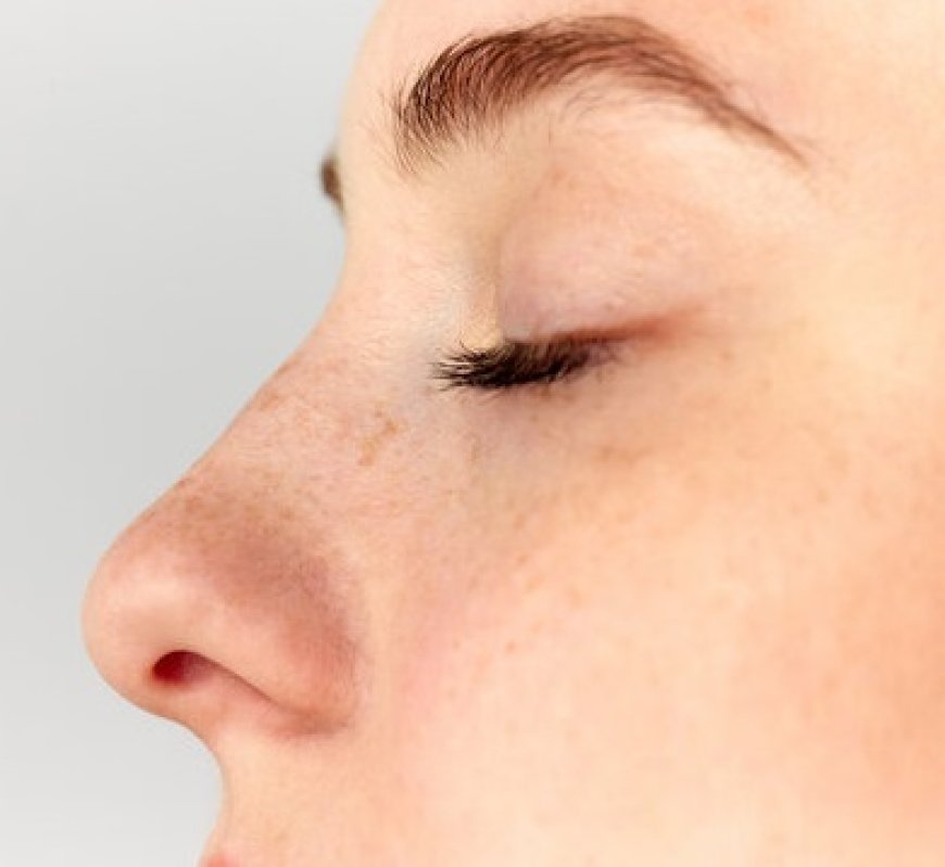Rhinoplasty in Islamabad: Tailoring Results to Your Face
