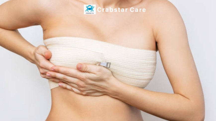 The Role of Professional Care in Breast Reconstruction Recovery