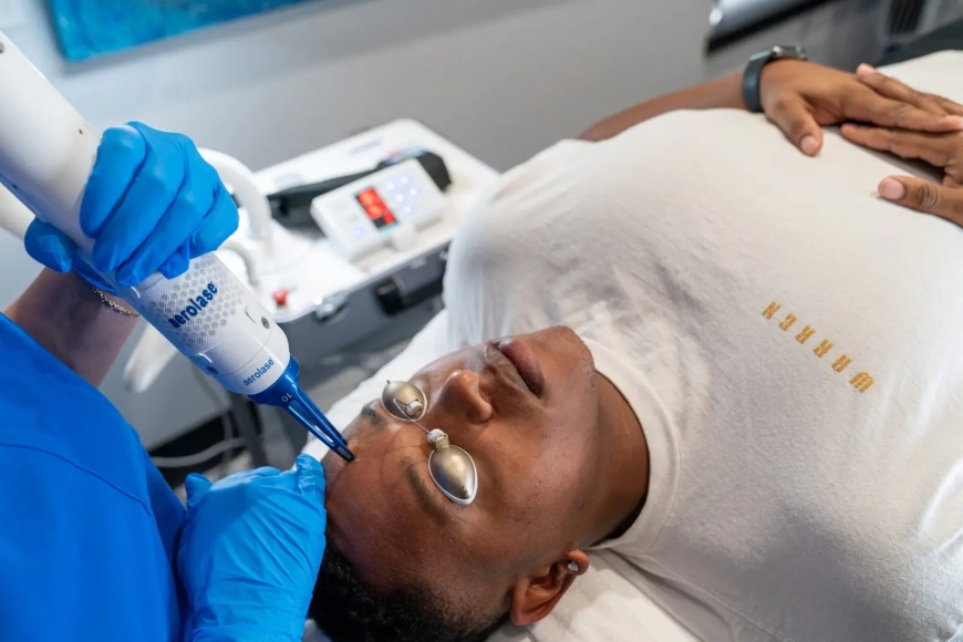 What Are the Benefits of Era Elite Laser Treatment for Sun Damage in Oshawa, Canada?