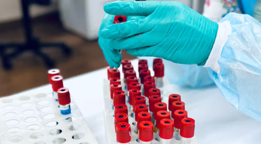 Blood Tests: Types, Results & How They Work