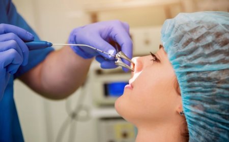What Is a Nose Balloon Procedure? Everything You Need to Know