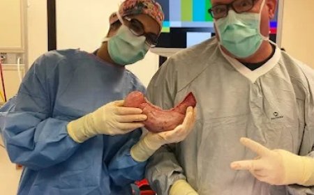 Redefining Surgery in Houston: From Gastric Bypass to Robotics and Beyond