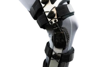 How Knee Braces Reduce Swelling and Improve Mobility in Arthritis