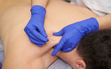 How IMS Dry Needling Helps Relieve Back and Neck Pain
