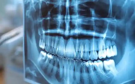 Top Reasons You May Require an OPG Scan