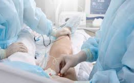 Your Straightforward Guide to Varicose Veins Treatment Cost in India with Dr. Sandeep Sharma (IR Facilities)