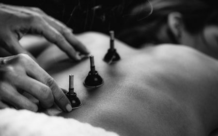 Revitalize Your Health and Beauty at Cure Wellness Center: Expert Cupping Therapy and Anti-Aging Treatments in Miami & Coral Gables