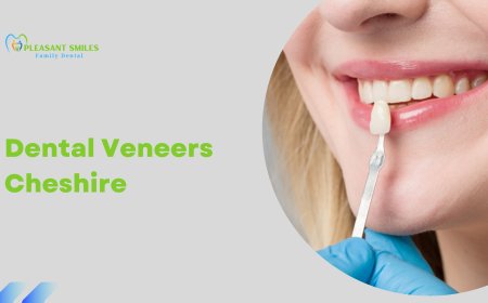 Transform Your Smile with Dental Veneers in Cheshire