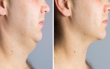 عملية تصغير الذقن في الرياض: الخيار الأمثل لمحبي الجمال الطبيعي