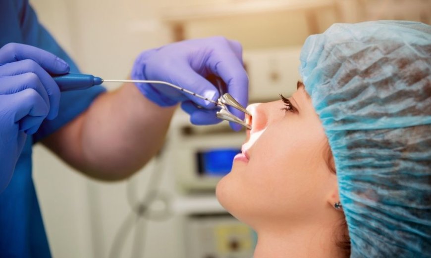 What Is a Nose Balloon Procedure? Everything You Need to Know