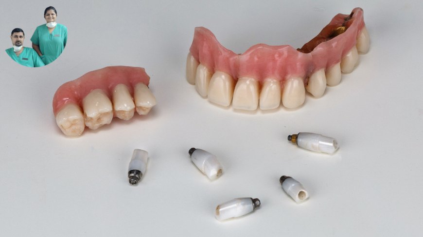 Get Fixed Teeth Instantly—Even If You Were Told You Had No Bone!