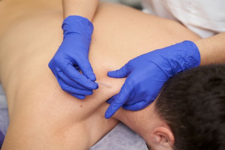 How IMS Dry Needling Helps Relieve Back and Neck Pain