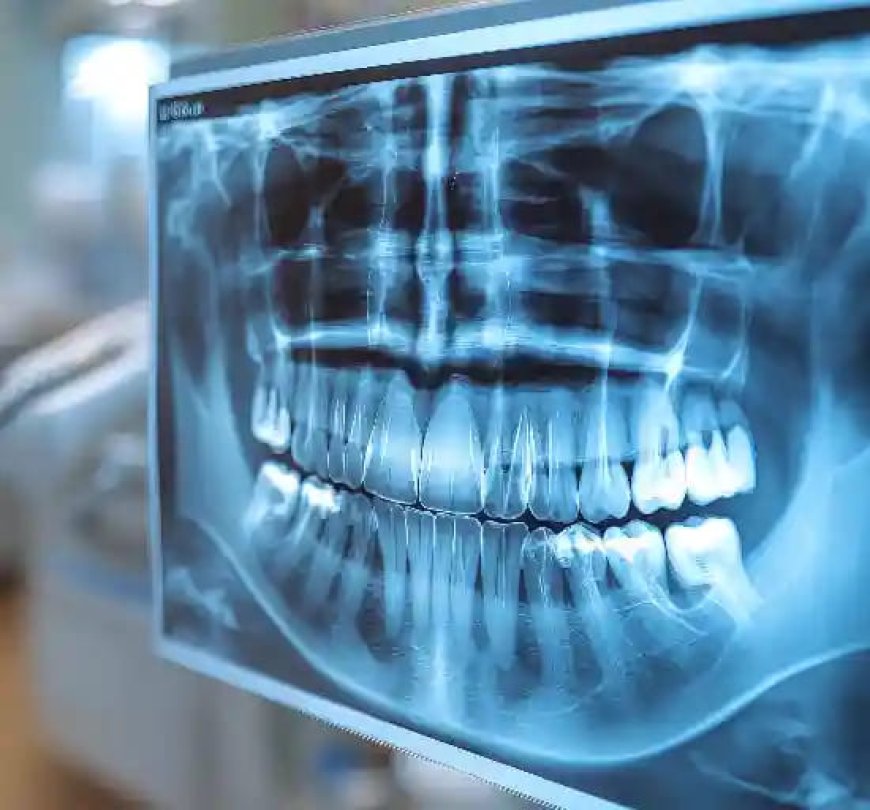 Top Reasons You May Require an OPG Scan