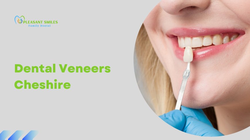 Transform Your Smile with Dental Veneers in Cheshire