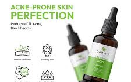 How Salicylic Acid Serum Fights Acne and Pimples