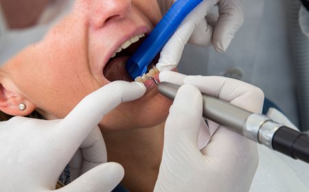 Transform Your Smile with Expert Dental Implants in Diamond Bar, CA