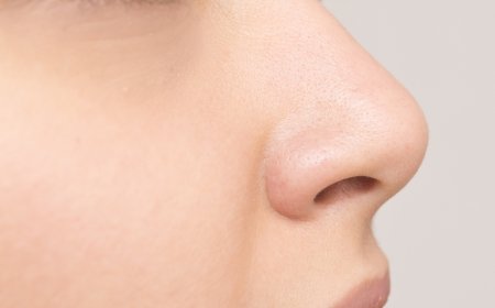 تجميل الأنف للرجال في الرياض: المزايا والتحديات