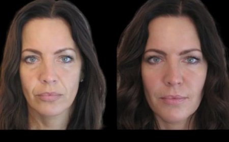 Best Plastic Surgeons in Dubai for Jawline Fillers: Safe and Effective Solutions