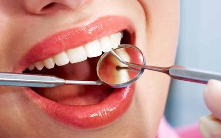 Teeth Straightening Marietta: How to Choose the Right Treatment for You