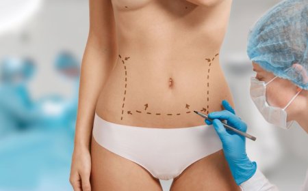 Top Liposuction Options in Delhi for a Sculpted Look