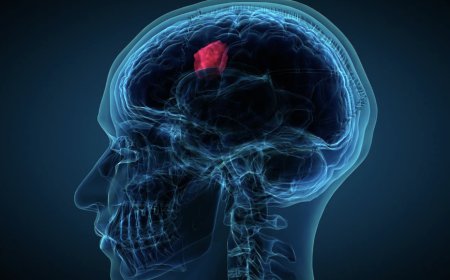 Advanced Brain Tumor Surgery in Gurgaon by Dr. Vikas Kathuria