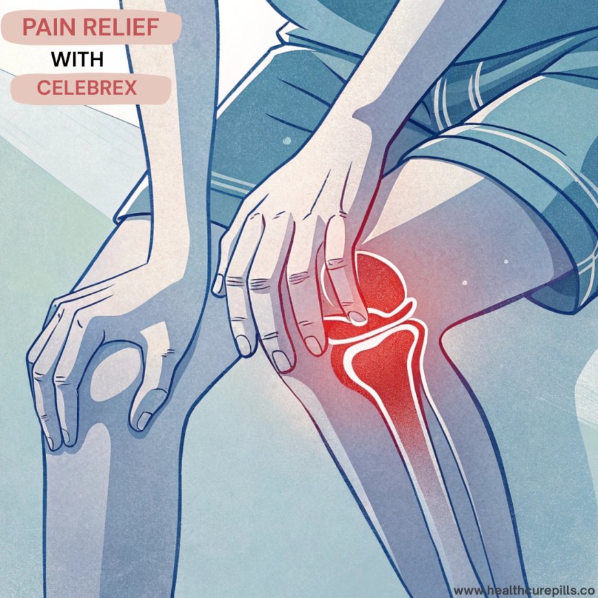 Nonsteroidal Anti-Inflammatory Pain Relief