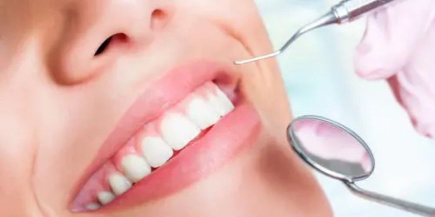 Benefits of Choosing a Private Dentist
