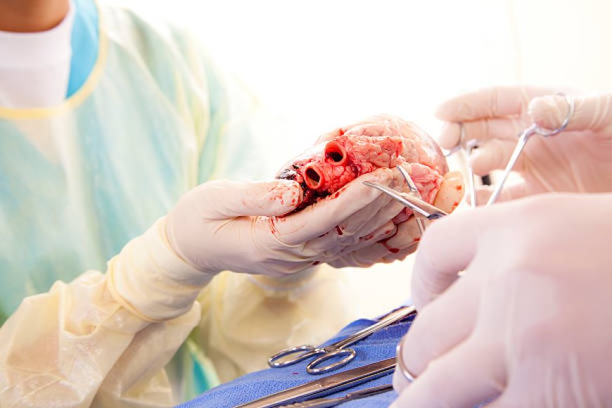 Heart Transplant Surgery: How Maddadgar Foundation Transforms Lives Through Advanced Medical Care