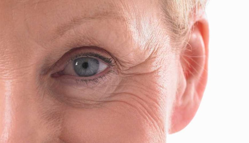 Is Eyelid Surgery Permanent? Here’s the Truth