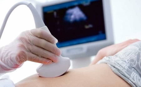 Ultrasound Machine Manufacturing Plant Report 2025: Materials Cost and Requirements